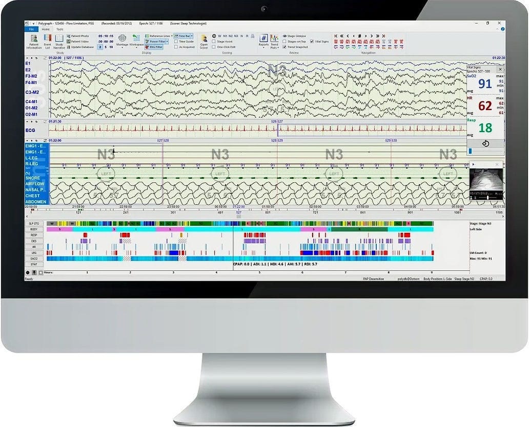 Logiciel médical Polysmith Neurotronics d analyse de gestion