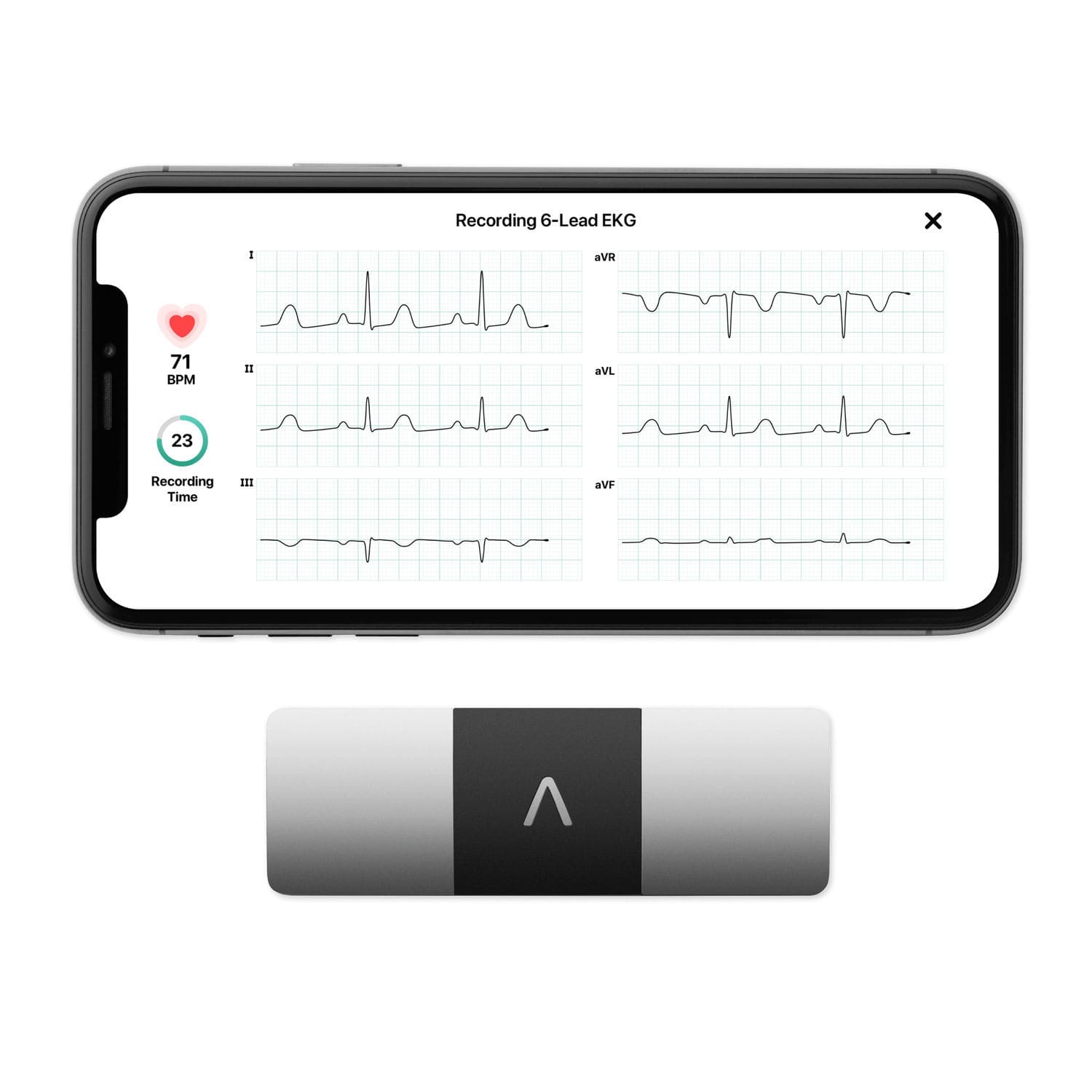 Moniteur Patient Portatif KardiaMobile 6L AliveCor ECG De