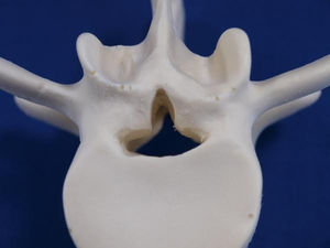 modèle anatomique disque intervertébral / vertèbre lombaire / d'enseignement / de pathologie