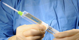 colle chirurgicale pour chirurgie vasculaire