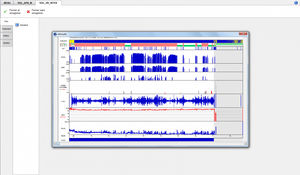logiciel d'analyse / pour polysomnographie / pour polygraphie / pour cabinet médical
