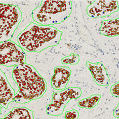 module logiciel d'oncologie / de visualisation / de diagnostic / pour immunohistochimie