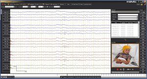 logiciel de contrôle / de monitorage / de capture / pour EEG