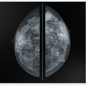 logiciel pour mammographie / d'amélioration d'image / de visualisation / de diagnostic
