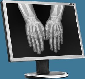 logiciel de visualisation DICOM / d'interopérabilité / pour imagerie médicale / pour service de radiologie