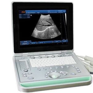 échographe portable / pour échographie polyvalente / noir et blanc / console intégrée