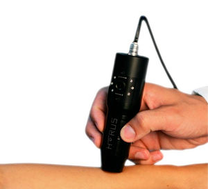 dermatoscope vidéo / LED blanche / USB / HD
