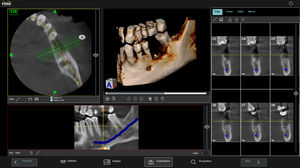 logiciel de gestion de compte rendu patient / de reporting / de visualisation 3D / de simulation
