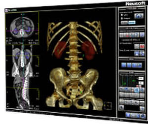 logiciel de visualisation / d'analyse / urologie / TDM