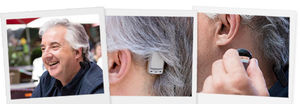 implant auditif à conduction osseuse partie interne / processeur boitier déporté / amovible