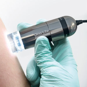 dermatoscope vidéo / à LED / de poche / USB