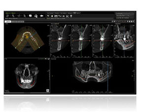 logiciel d'analyse / de diagnostic / TDM / dentaire