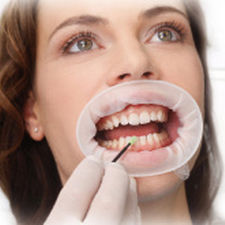 écarteur de joue / labial / dentaire