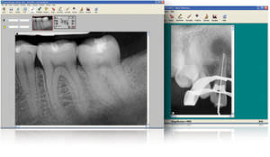 logiciel de visualisation / de fichier DICOM / de radiographie / dentaire