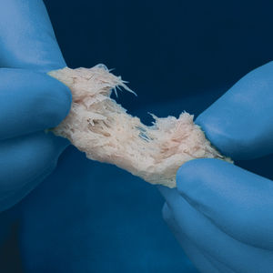 substitut osseux allogreffe / pour chirurgie orthopédique / malléable