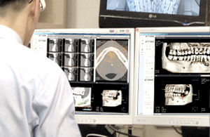 logiciel de simulation d'implant dentaire / de reporting / de fichier DICOM