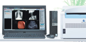 système d'acquisition pour radiographie / portable