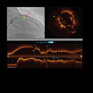 logiciel de visualisation / pour angiographie