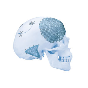 implant crânien