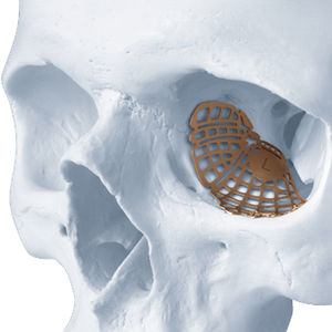 implant périorbital