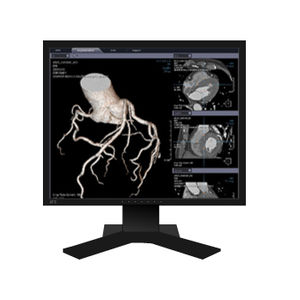 logiciel d'analyse / de visualisation 3D / de diagnostic / d'évaluation