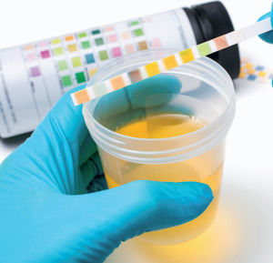 bandelette de test pour analyse d'urine / de métabolites urinaires / de pH / de nitrite