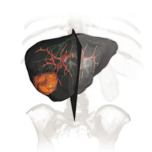 module logiciel de simulation 3D / d'analyse / de radiographie / de chirurgie