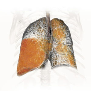 module logiciel de planification / d'analyse / de simulation / pour radiologie