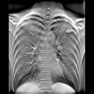 logiciel d'acquisition / pour imagerie médicale / automatisé