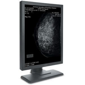 écran mammographique / pour radiologie / LCD / à rétroéclairage LED