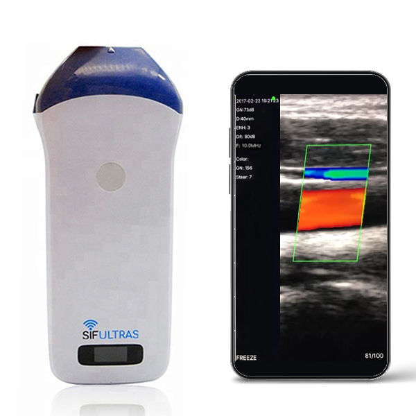 A Quoi Sert Le Gel Echographie Échographe portatif - SIFULTRAS-3.53 - SIFSOF - pour échographie en