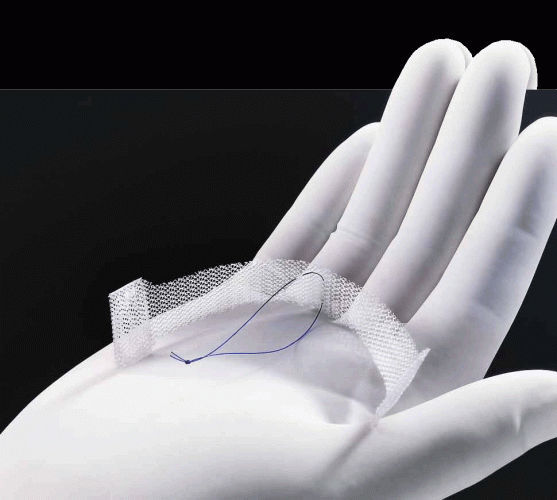 Bandelette de reconstruction pour l'incontinence urinaire Needleless