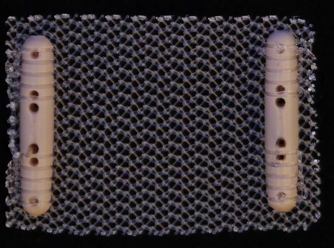 Bandelette de reconstruction pour l'incontinence urinaire MRS II