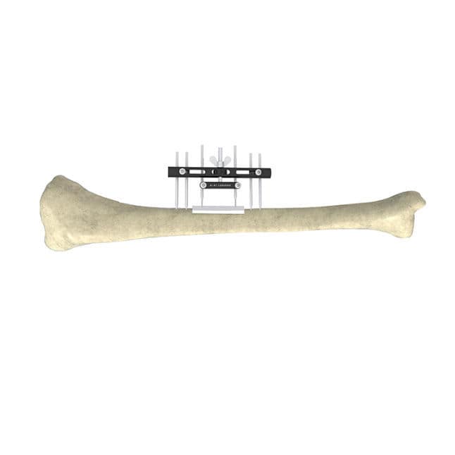 Fixateur externe de tibia Wuxi Betta Medical Technology tubulaire Fixateur externe de tibia Wuxi Betta Medical Technology tubulaire