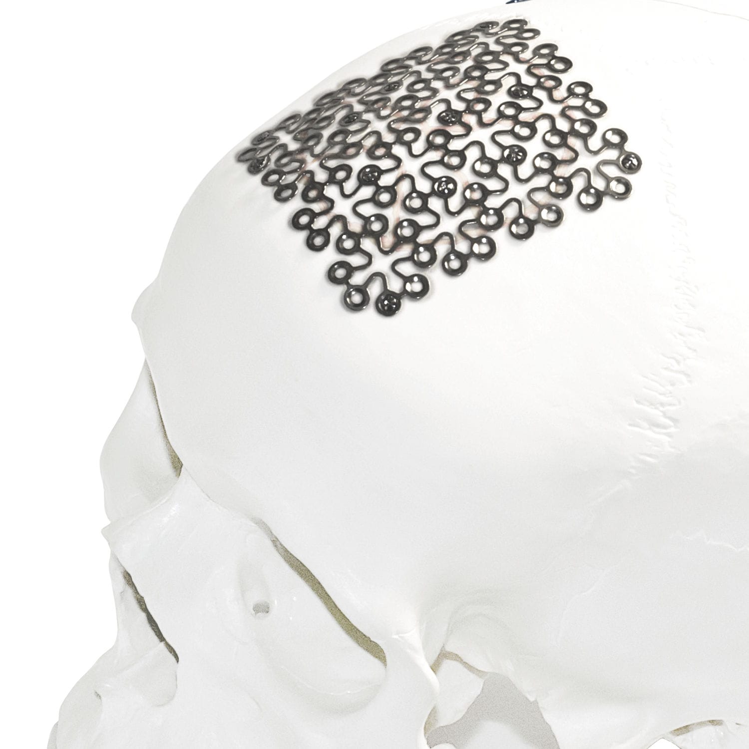 Implant crânien Titanium Mesh Jeil Medical Corporation