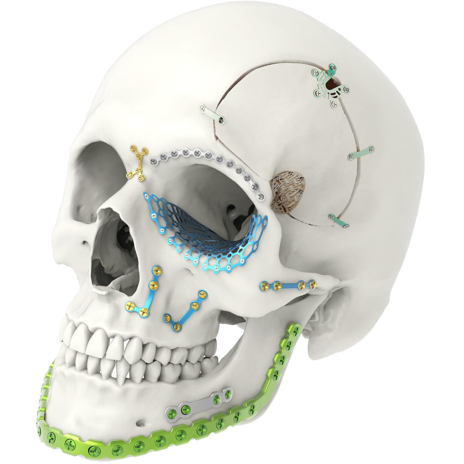 Plaque En Alliage De Titane TA2 | Premier Fabricant D