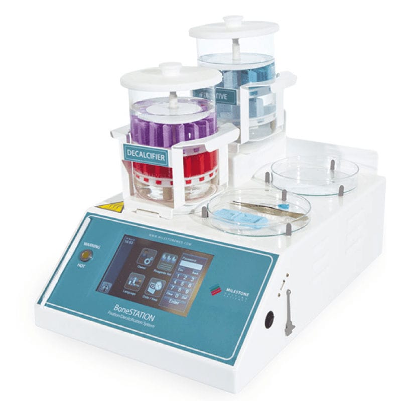 Système de décalcification de fixation BoneSTATION Milestone du