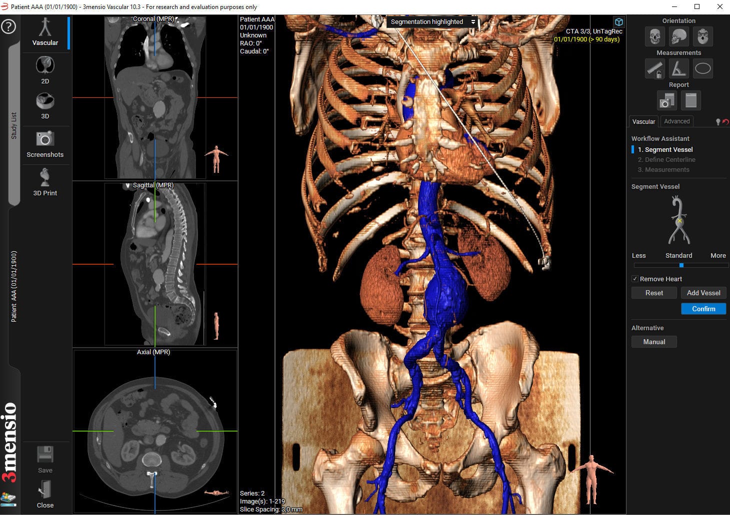 Logiciel médical 3mensio Vascular Pie Medical Imaging TDM / pour