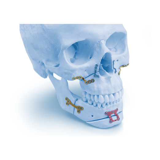 Plaque de compression maxillaire Matrix ORTHOGNATHIC™ Depuy Synthes mandibule