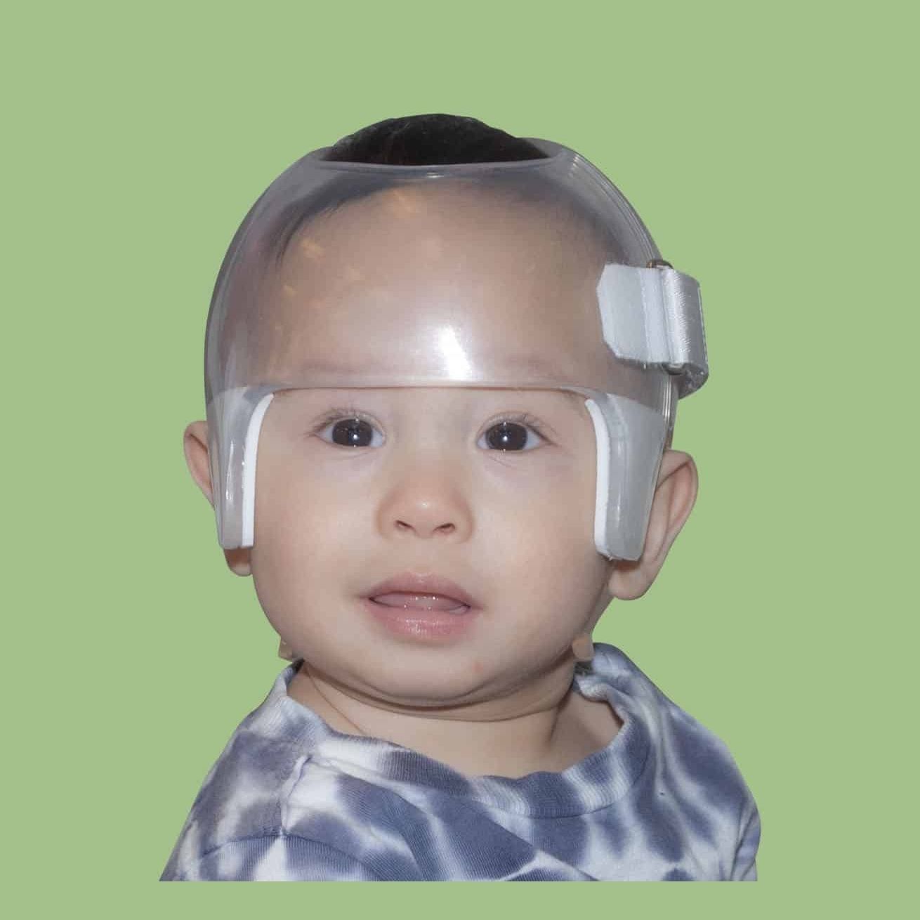 Orthèse crânienne STARlight™ Orthomerica pédiatrique