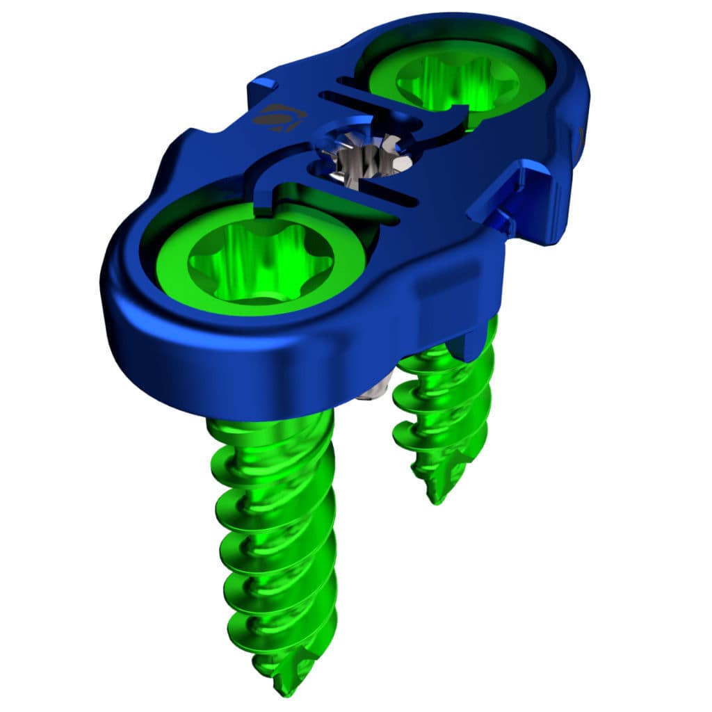 Plaque d'arthrodèse de vertèbre lombaire AMP™ Alphatec Spine