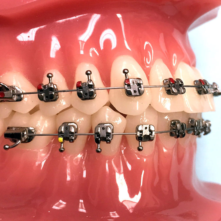 Bracket orthodontique en métal Agility® G&H Orthodontics auto