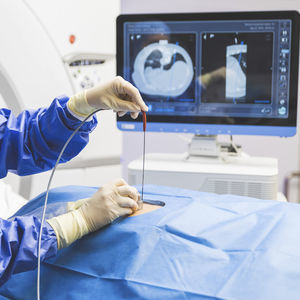 système de biopsie hépatique
