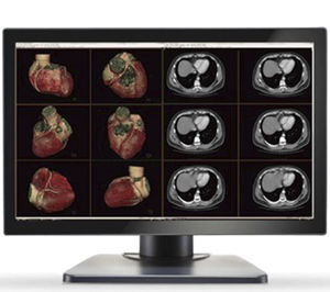 écran de diagnostic