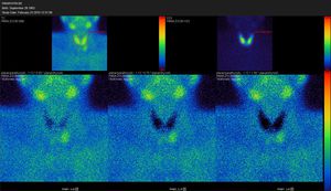 logiciel SPECT