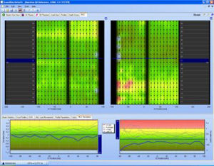 logiciel pour radiothérapie