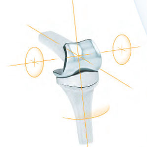 implant d'articulation interphalangienne de la main