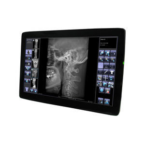 système d'acquisition pour radiographie