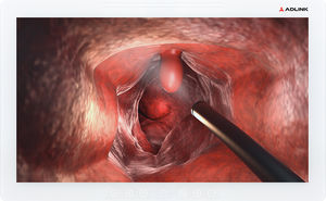 moniteur chirurgical