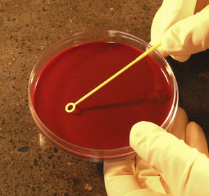 kit de test de Taylorella equigenitalis / pour maladies infectieuses / pour chevaux / de sang